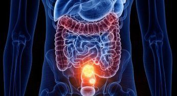 Campagna di prevenzione tumore colon retto, test in farmacia
